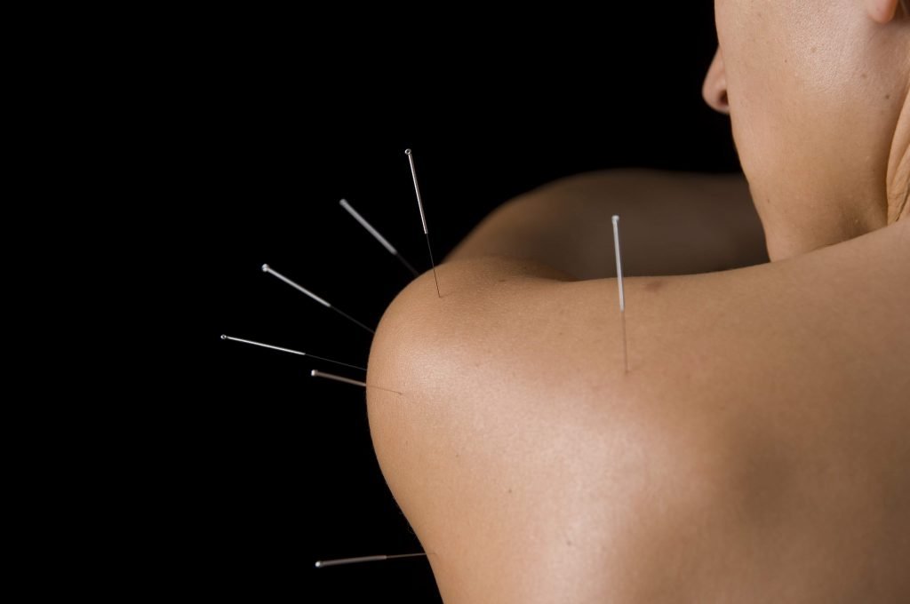 Shoulder Acupuncture Points