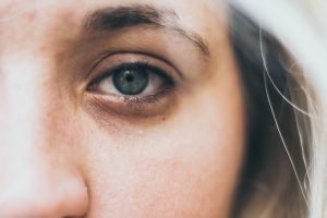 Blonde Woman Eye Close up - Eye overuse is an internal cause of disease