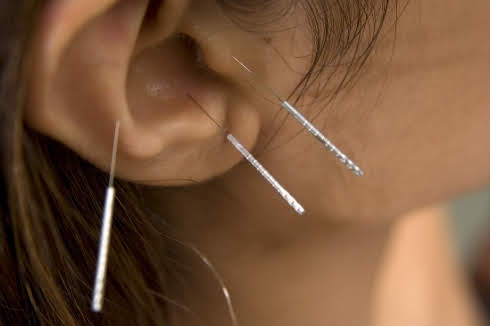 Acupuncture points in the ear