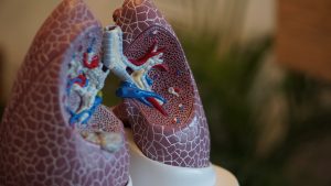 Phlegm in Lungs causes breathlessness
